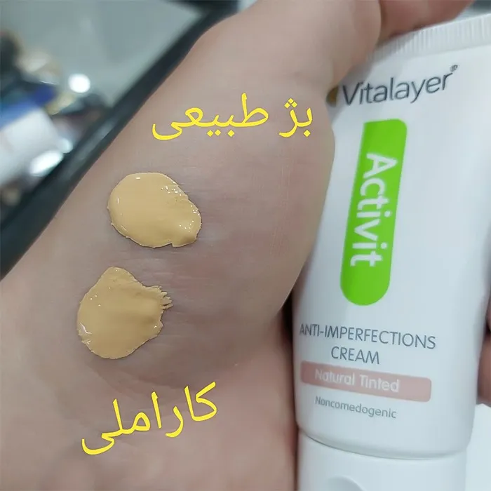 نمونه رنگ‌بندی  کرم ضد جوش رنگی اکتی ویت طبیعی ویتالیر